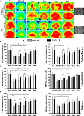 Prostaglandin E1 Alleviates Cognitive Dysfunction in Chronic <mark class="highlighted">Cerebral Hypoperfusion</mark> Rats by Improving Hemodynamics